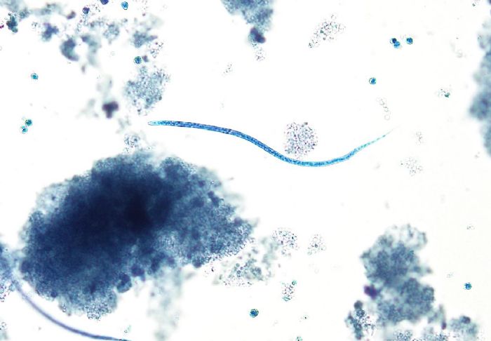 Heartworm microfilaria
