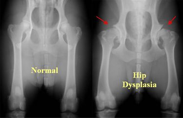 X-ray of Hip Dysplasia